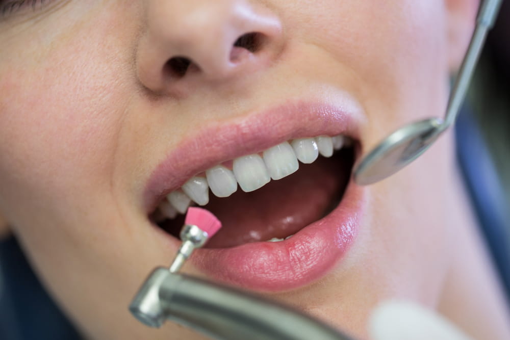 How Long Does a Dental Cleaning Take?